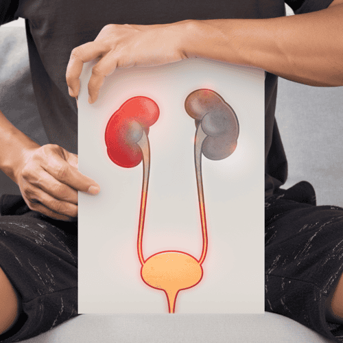 Stem Cell Urinary Infection Renal Damage Treatment in Mexico City